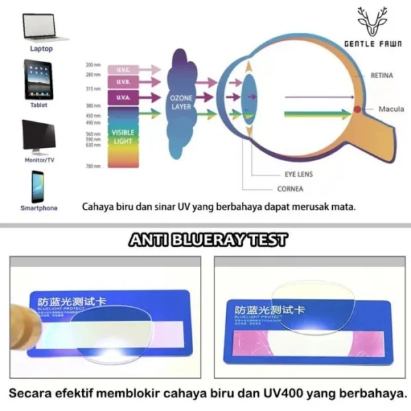Gentle Fawn Kacamata Anak/Remaja Antiradiasi Blueray Sinar Biru Bahan Tr90 Style Kotak Keren Laki-laki Dan Perempuan Keren 8812 - Image 4